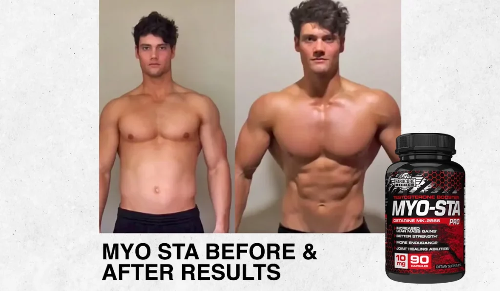 MYO STA Before & After Results